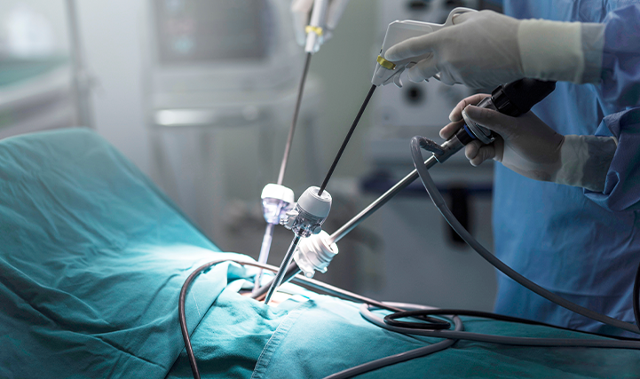 Minimally Invasive Surgery